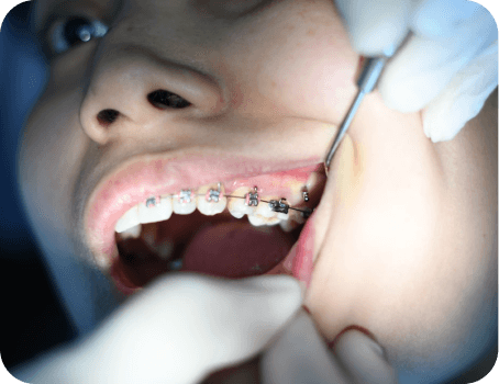 Child receiving emergency dental care with braces adjustment